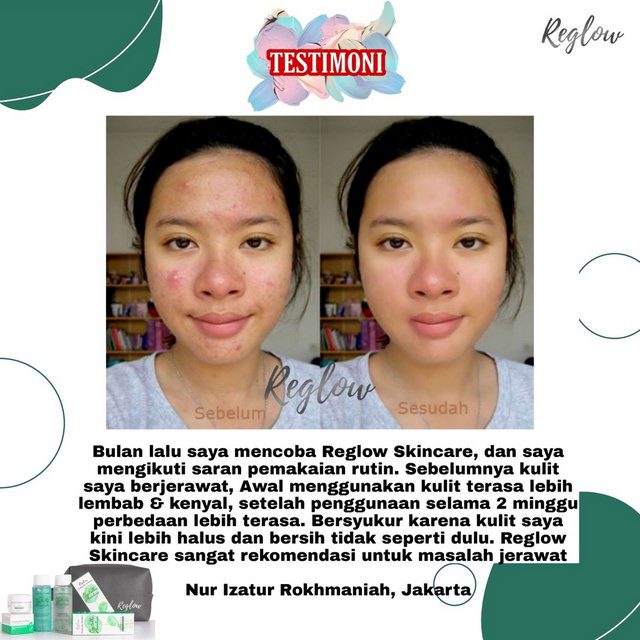 reglow-testimoni-jerawat